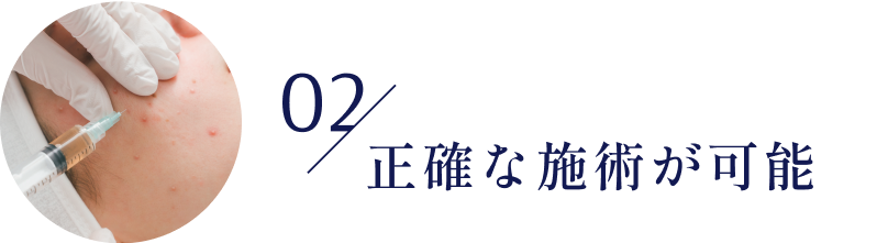 02/正確な施術が可能