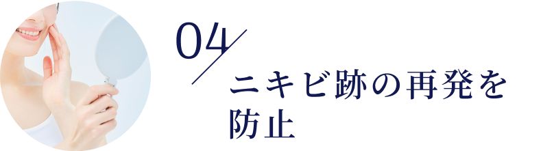 04/ニキビ跡の再発を防止