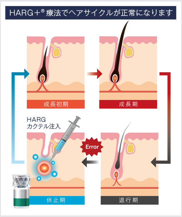 HARG+®（ハーグプラス®）療法でヘアサイクルが正常になります。