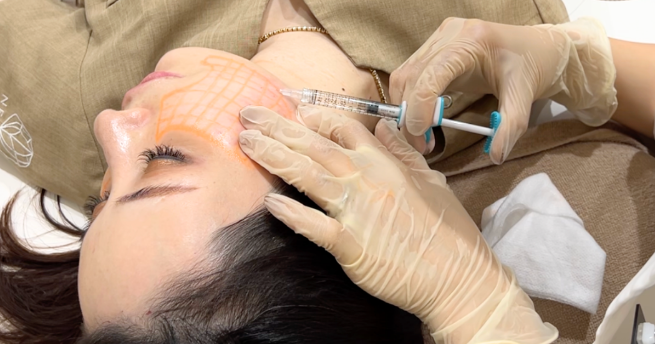 スキンバイブ（ボライト）